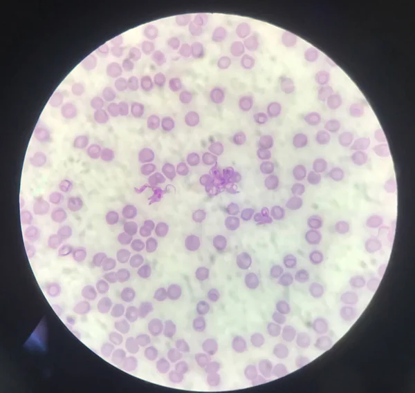 血液寄生虫 赤血球上のトリパノソーマ医学的背景概念 ロイヤリティフリーのストック画像