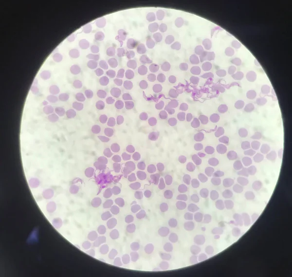 血液寄生虫 赤血球上のトリパノソーマ医学的背景概念 ストック写真