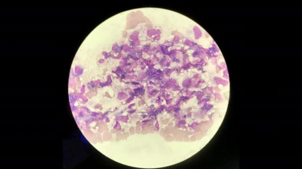 Kan Lekelerinde Beyaz Kan Hücresi Ile Vdo Maya Hücrelerinin Fagositoz — Stok video