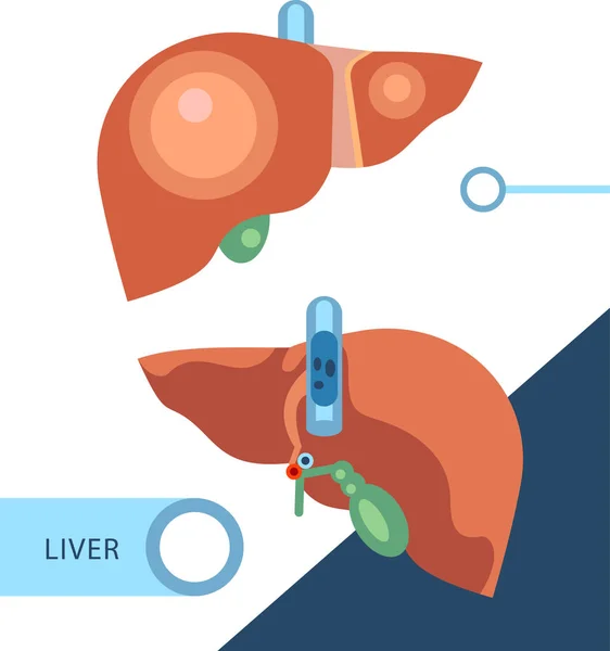 Ilustración gráfica del hígado — Vector de stock