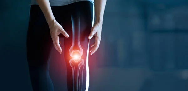 Woman suffering from pain in knee, Injury from workout and osteoarthritis, Tendon problems and Joint inflammation on dark background. — Stock Photo, Image