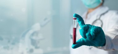 Coronavirus kan testi, laboratuvarın arka planında CVid-19 için kanla test cam tüpü tutan doktor.. 