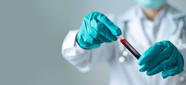Coronavirus kan testi, kovid 19 analizi için kan dolu cam tüp tutan doktor.. 