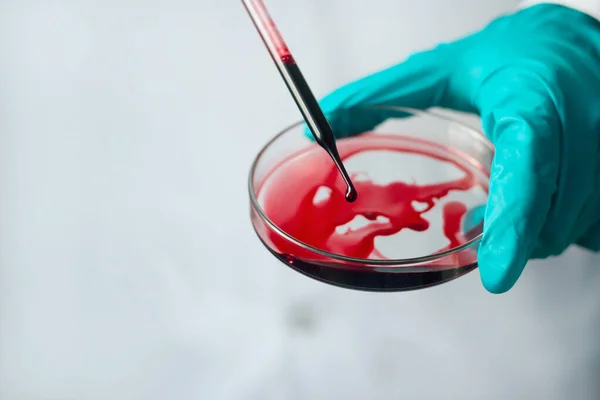 Наука Медицина Вчений Аналізує Скидає Кров Зразок Скляну Посудину Експерименти — стокове фото