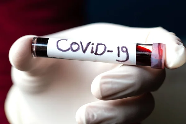 Sampel darah Covid-19, dokter mengenakan sarung tangan medis memegang tabung darah dengan positif Coronavirus 2019-nCoV Sampel darah . — Stok Foto