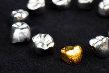 Diş kron koyu siyah yüzeyinde diş altın ve metal.