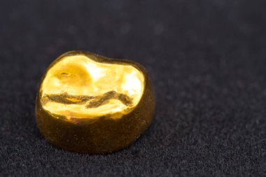 Koyu siyah yüzeyinde diş altın metal diş taç.