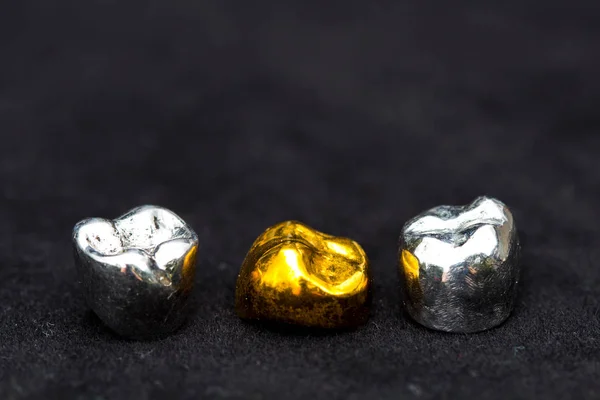Zahngold und Zahnkronen aus Metall auf dunkelschwarzer Oberfläche. — Stockfoto