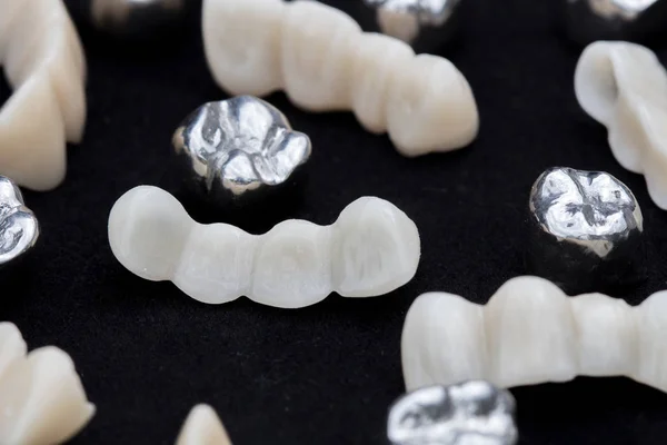 Coronas dentales de metal plateado y puentes dentales de cerámica o circonio sobre superficie negra oscura . —  Fotos de Stock