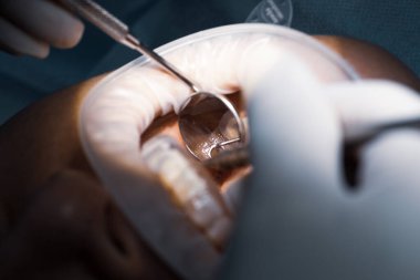 Işık bulanık arkaplanda diş matkabını kapat