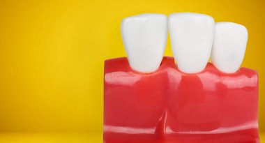 Kopyalama alanı olan diş modeli