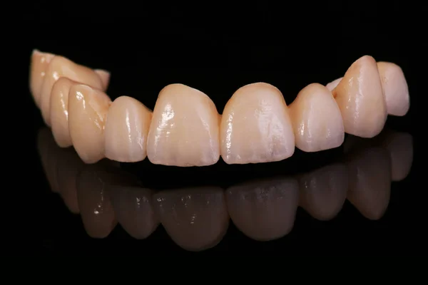 Koronki dentystyczne. Zbliżenie ceramiczna korona zęba — Zdjęcie stockowe