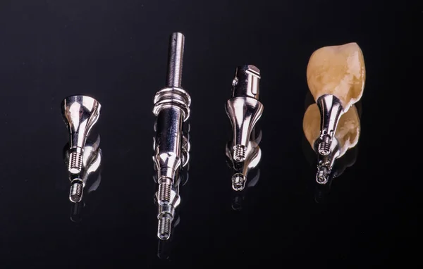 Implante dental de dientes humanos, primer plano. Concepto tecnología dental — Foto de Stock