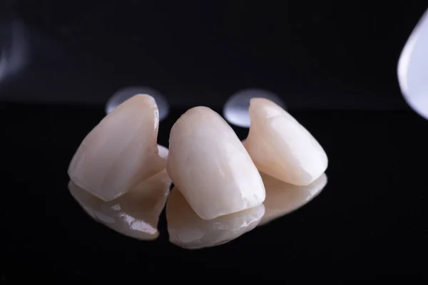Coronas dentales de cerámica en negro con espejo — Foto de Stock