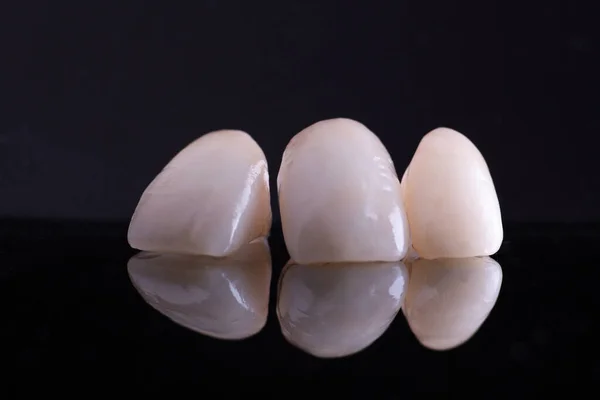 Dental coroas de cerâmica no preto com espelho — Fotografia de Stock
