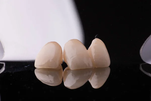 Chapas de cerámica sobre fondo negro. concepto de dientes de odontología — Foto de Stock