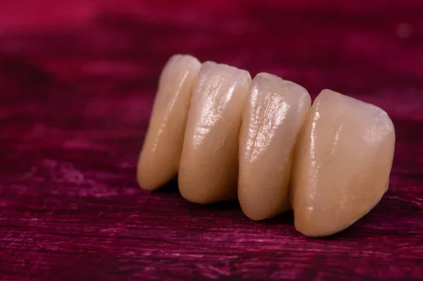Coronas dentales de cerámica en rojo. Cerrar corona de dientes — Foto de Stock