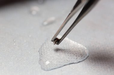 implant dişçilik işini kapat