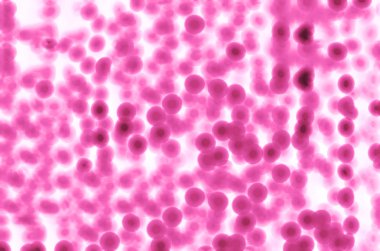 Pembe nokta bokeh arka plan