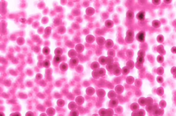 Pembe nokta bokeh arka plan