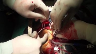 Adam cerrahi profesyonel doktor eller benzersiz video kalbinde yakın çekim Kliniği.