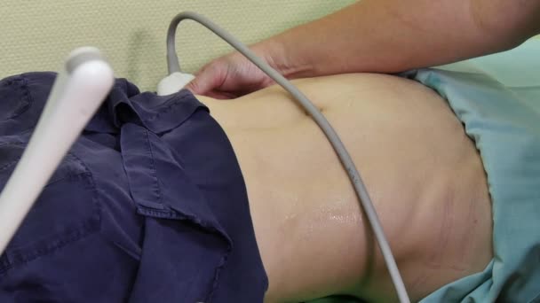 Exame ultra-sonográfico de mulher paciente da cavidade abdominal . — Vídeo de Stock