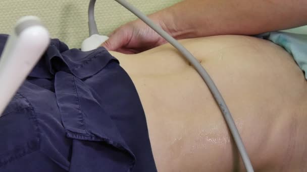 Examen ecográfico de la mujer paciente con cavidad abdominal . — Vídeos de Stock