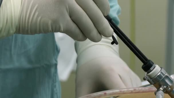 Κοιλιακό λαπαροσκόπηση σε χειρουργείο γκρο πλαν. — Αρχείο Βίντεο