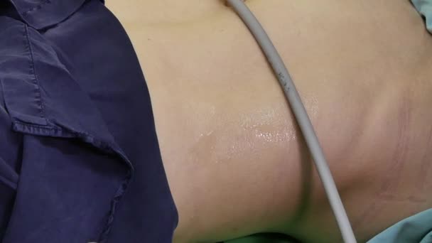 Exame ultra-sonográfico de mulher paciente da cavidade abdominal . — Vídeo de Stock