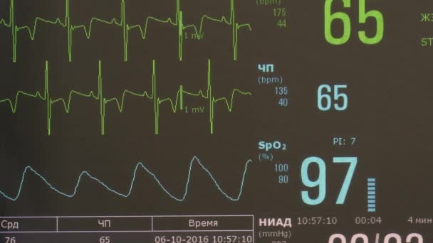 Καρδιογράφημα ρυθμό της καρδιάς και παλμό εικόνα στην οθόνη κατά τη διάρκεια λειτουργίας. — Αρχείο Βίντεο