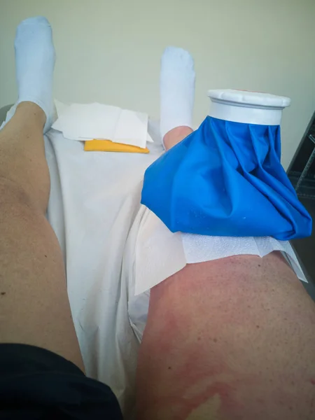 Human Leg with Muscles Electrostimulation Device and Ice Bag during Rehabilitation Exercises on Bed After Knee Surgery.