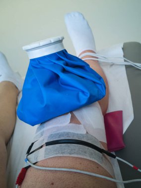 Kas Elektrostimülasyon Cihazı ve Buz Torbası ile İnsan Bacağı Dizden Sonra Tedavi Egzersizleri sırasında.