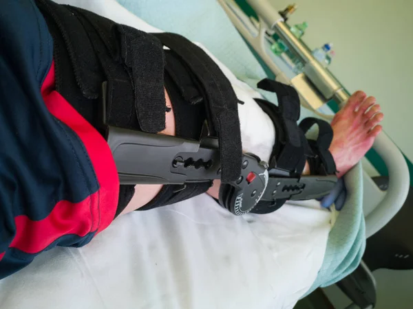 Human Leg with Patches and Orthopedic Brace After Anterior Cruciate Ligament Surgery: in Bed at Hospital.