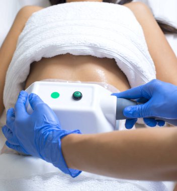 genç kadın cryolipolyse kozmetik kabine muamele