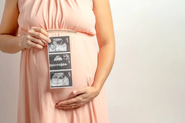 Zwangere Vrouwen Met Rekwisieten Met Een Röntgenfoto Van Baby Erop — Stockfoto