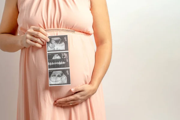 Donne Incinte Che Tengono Oggetti Scena Con Immagine Raggi Del — Foto Stock