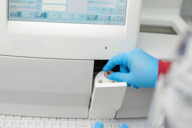 Biyokimyacı, koronavirüsün pozitif olup olmadığını anlamak için kan testini kontrol ediyor.