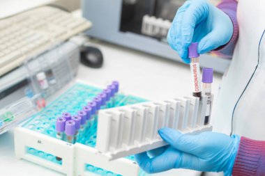 doctor hand taking a blood sample tube from a rack with machines of analysis in the lab background / Technician holding blood tube with coronavirus positive sample in the research laboratory
