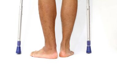 Achilles tendon yırtığı ve crutchs işlemi skar