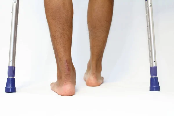 Achilles tendon yırtığı ve crutchs işlemi skar
