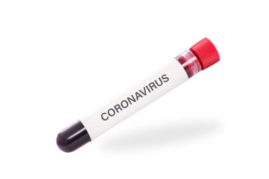 Virüs COVID-19 salgın konsepti - beyaz arka planda izole edilmiş Coronavirus metni olan tek bir kan örneği tüpü