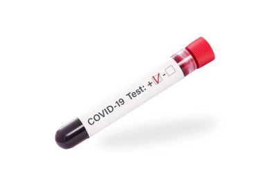 Virüs COVID-19 salgın konsepti. Beyaz arka planda pozitif test işaretli tek bir kan örneği tüpü.