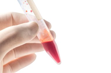 Koruyucu eldiven şişe tutan eliyle