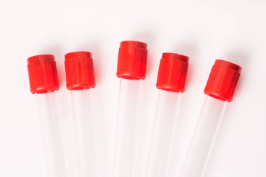 test tüpleri için kan örnekleri ile kırmızı bere
