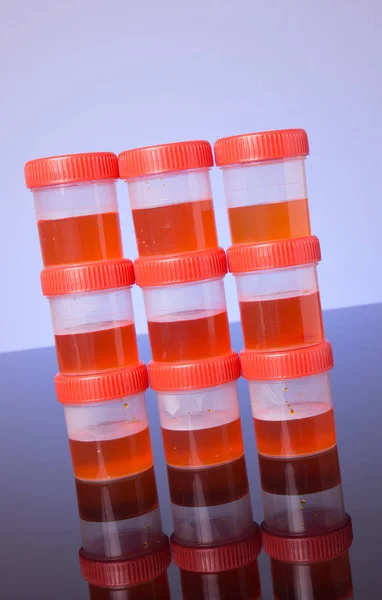 Pilha de tubo de amostra de urina — Fotografia de Stock