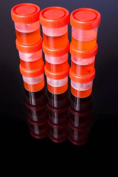 Pile de tube d'échantillon d'urine — Photo