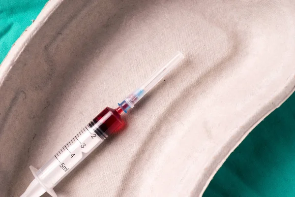 Seringue médicale, échantillon de sang couché dans une capsule à usage unique — Photo