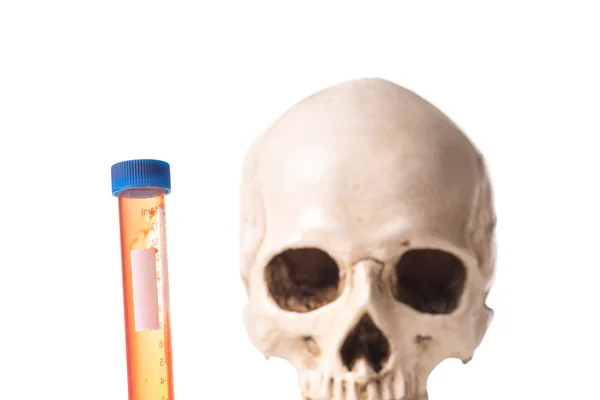 Blood sample and skull — Stock Photo, Image