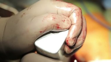 Cerrahi testere kullanımı