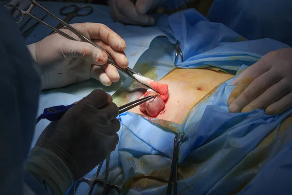 Área cirúrgica durante a cirurgia — Fotografia de Stock